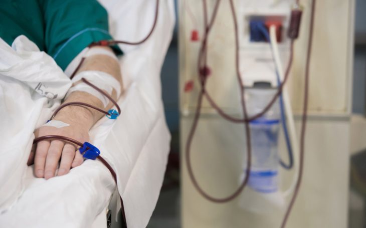 Acesso Vascular para Diálise