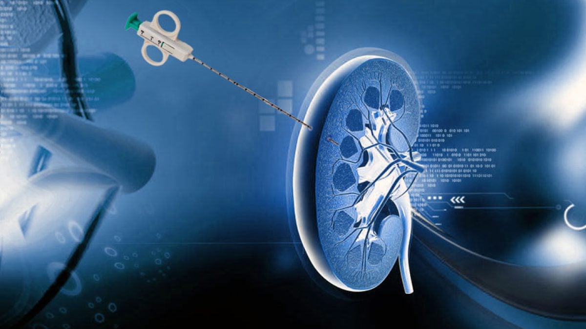 Biópsia Renal